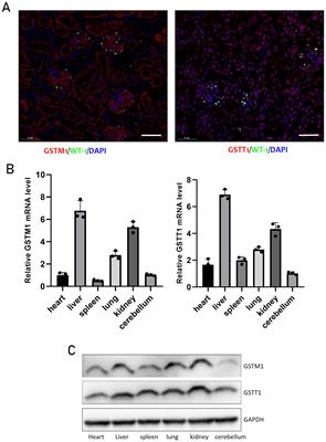 GSTT1/GSTM1 deficiency aggravated cisplatin-induced acute kidney injury via ROS-triggered ferroptosis